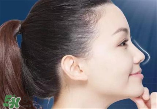 隆鼻會(huì)拉近眼距嗎？隆鼻會(huì)改變眼睛嗎？