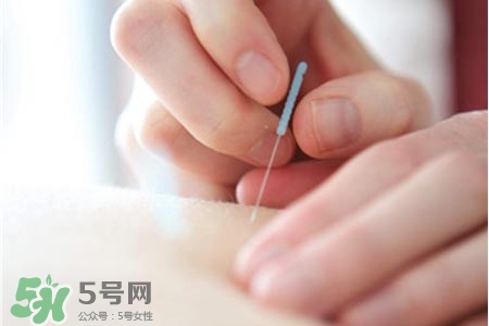 沒病可以針灸嗎？沒病可以扎針嗎？