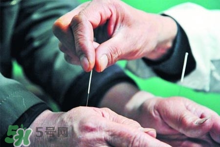 沒病可以針灸嗎？沒病可以扎針嗎？