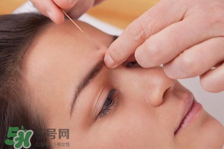 沒病可以針灸嗎？沒病可以扎針嗎？