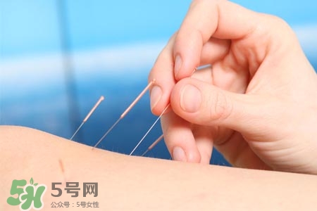 沒病可以針灸嗎？沒病可以扎針嗎？