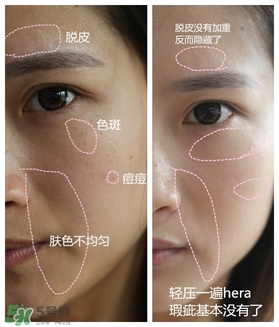 赫拉氣墊用了悶痘嗎？赫拉氣墊悶痘怎么辦？