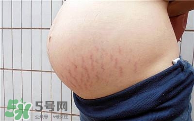 妊娠紋幾個月開始出現(xiàn)？妊娠紋能消除掉嗎？