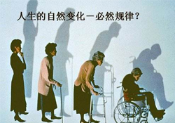 哪些人容易得骨質(zhì)疏松癥？骨質(zhì)疏松的高發(fā)人群有哪些？
