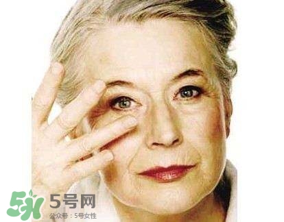 老年斑是怎么形成的？老年斑的形成原因