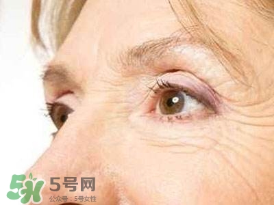 老年斑是怎么形成的？老年斑的形成原因
