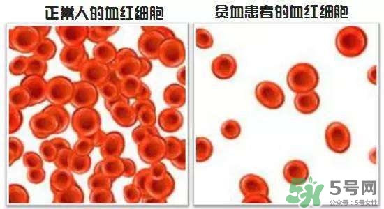 缺鐵性貧血的癥狀 缺鐵性貧血的癥狀有哪些？