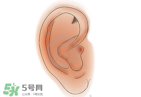 中耳炎有什么癥狀？中耳炎的癥狀表現(xiàn)