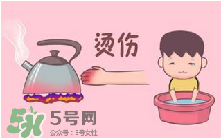 燙傷可以用牙膏嗎？燙傷用牙膏管用嗎？