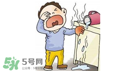 燙傷可以用牙膏嗎？燙傷用牙膏管用嗎？