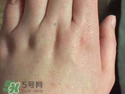 薇諾娜適合什么皮膚？薇諾娜適合敏感肌嗎？