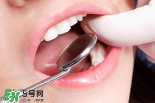 口腔異味是怎么回事？口腔異味怎么清除？