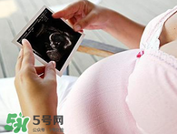 保胎期間可以洗澡嗎？臥床保胎可以洗澡嗎？