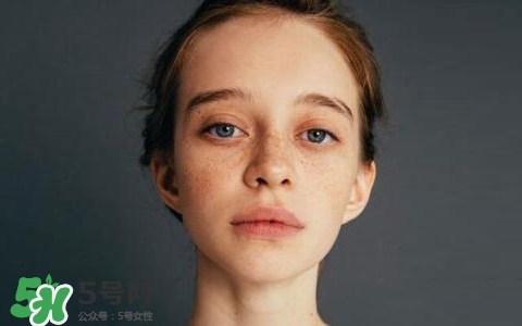 長(zhǎng)斑是什么原因引起的？祛斑效果最好的方法