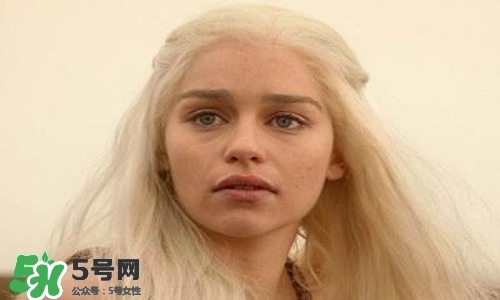 臉色發(fā)黃是什么原因？臉色發(fā)黃吃什么調(diào)理更好？