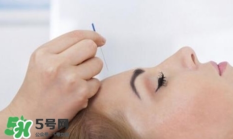 叢集性頭痛會(huì)死人嗎？叢集性頭痛的特點(diǎn)