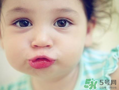孕期可以激光祛斑嗎？懷孕了能做激光祛斑嗎？