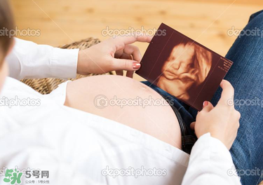 橄欖油真的可以預(yù)防妊娠紋嗎？橄欖油真的可以去妊娠紋嗎？