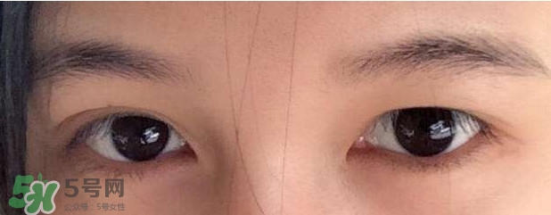 眼睛發(fā)黃是怎么回事？眼睛發(fā)黃是什么原因