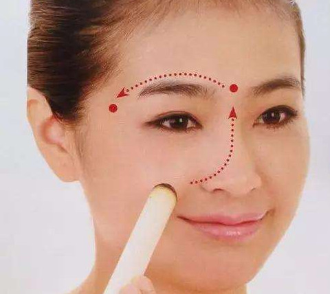 艾灸可以去黑眼圈嗎？艾灸可不可以去黑眼圈