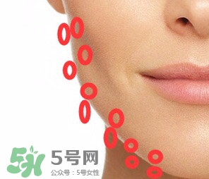 nuface美容儀有效嗎？nuface美容儀副作用？