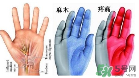 手腳發(fā)麻是缺鈣嗎？手腳發(fā)麻是不是缺鈣