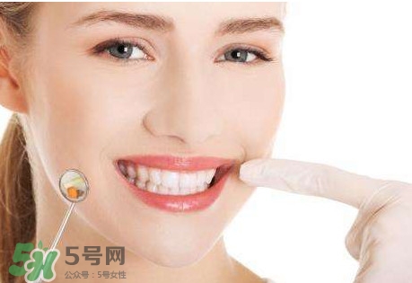 如何去掉牙結(jié)石？牙結(jié)石怎么去除