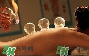 拔火罐疼嗎？拔火罐疼不疼