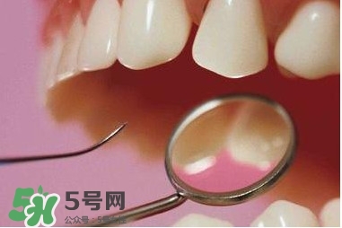 牙周炎傳染嗎？牙周炎會不會傳染