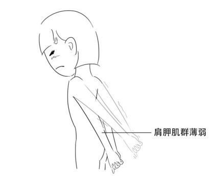 高低肩怎么糾正？高低肩的危害