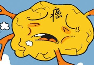 胃癌是怎么引起的？胃癌的早起癥狀