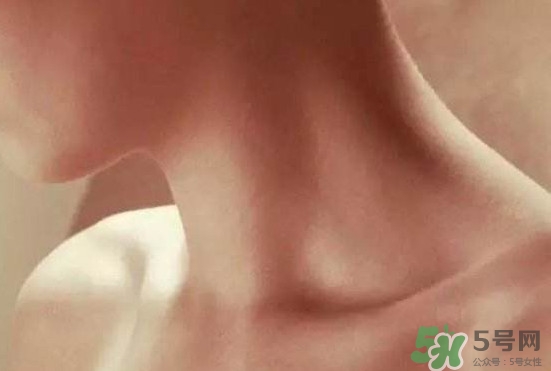 頸椎老化是什么病？頸椎老化的癥狀