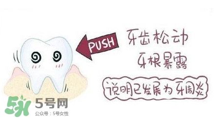 牙齒松動(dòng)能自己恢復(fù)嗎？牙齒松動(dòng)會(huì)自己恢復(fù)嗎