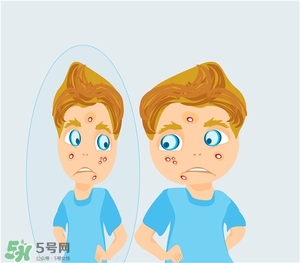 得了痤瘡飲食注意什么？有痤瘡吃東西注意什么