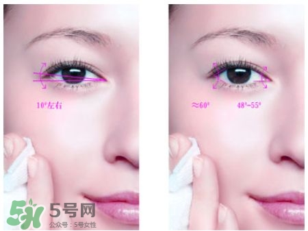 開(kāi)眼角可以吃醬油嗎?開(kāi)眼角吃醬油好嗎?