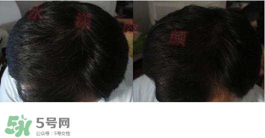  資生堂不老林洗發(fā)水怎么樣？資生堂不老林洗發(fā)水能長(zhǎng)頭發(fā)嗎