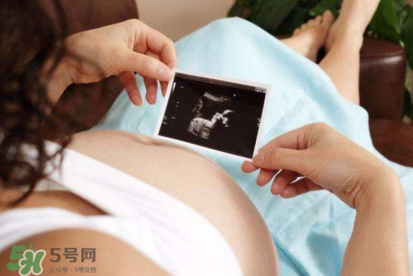 四維彩超能看出男女嗎？四維彩超能看清手指嗎？