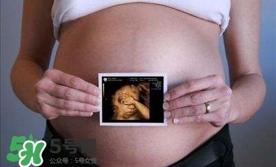 四維彩超能看出男女嗎？四維彩超能看清手指嗎？