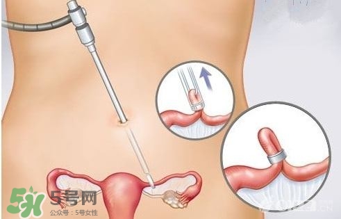 女人怎樣避孕最安全？對(duì)女人最好的避孕方法