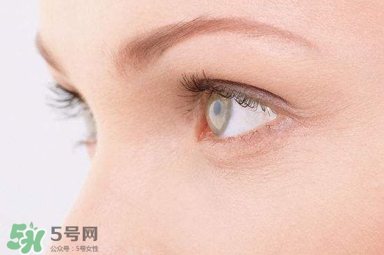 眼睛布滿血絲怎么回事？眼睛布滿血絲怎么辦