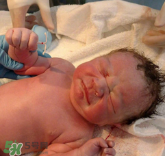 新生兒手握避孕環(huán)出生是怎么回事？出生后健康嗎？