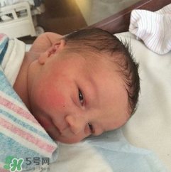新生兒手握避孕環(huán)出生是怎么回事？出生后健康嗎？