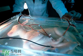 人造子宮能生孩子嗎？人造子宮成功案例