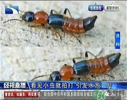 隱翅蟲有毒嗎？隱翅蟲會(huì)毀容嗎？