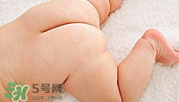 尿布疹怎么辦？寶寶尿布疹擦什么藥好？
