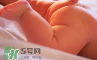 寶寶尿布疹可以擦紅霉素軟膏嗎？紅霉素軟膏對(duì)尿布疹有效嗎？