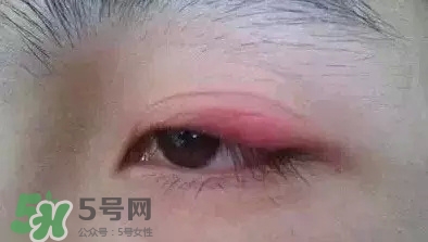 長期用假睫毛雙眼皮貼對眼睛有什么傷害？