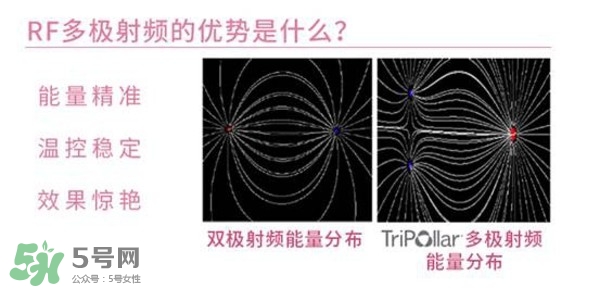 tripollar stop怎么樣？tripollar pose好用嗎