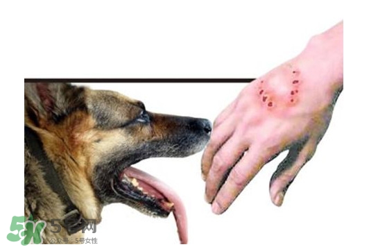 狂犬病會(huì)傳染嗎？狂犬病會(huì)學(xué)狗叫嗎