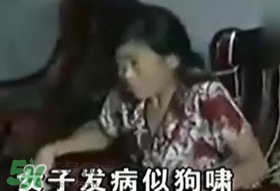狂犬病能治好嗎？狂犬病的早期癥狀